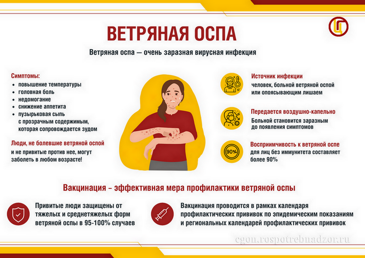 Памятка "Ветряная оспа".